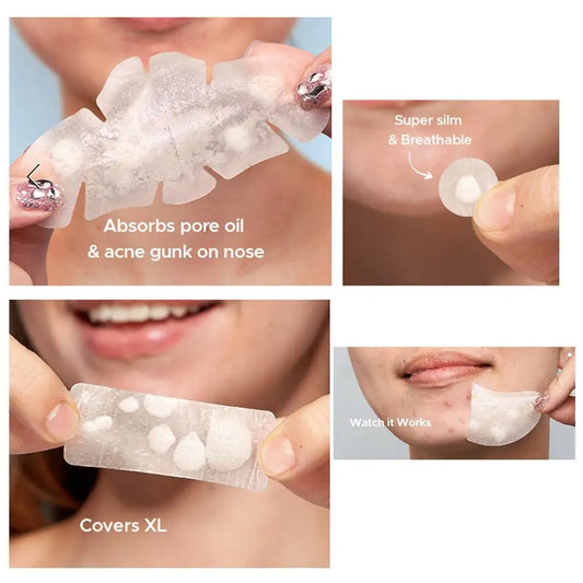 Pimple Patches for Acne & Blemishes